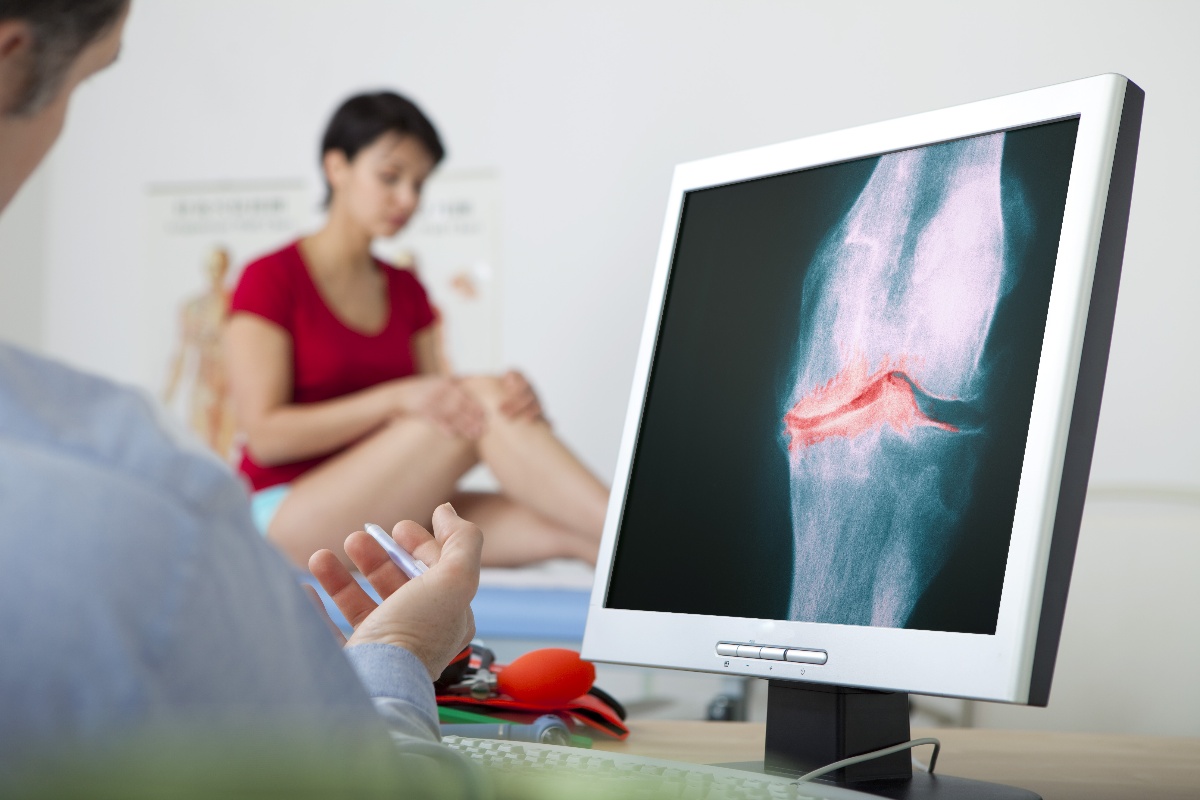 What are the Risk Factors for Osteoarthritis?